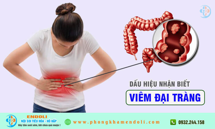 Dấu hiệu nhận biết viêm đại tràng 